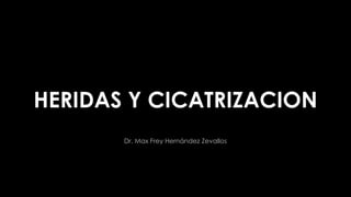 HERIDAS Y CICATRIZACION
Dr. Max Frey Hernández Zevallos
 