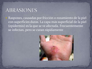 Como Curar Raspones Heridasyhemorragias | PPTX