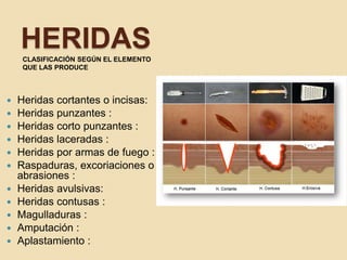 HERIDASCLASIFICACIÓN SEGÚN EL ELEMENTO
QUE LAS PRODUCE
 Heridas cortantes o incisas:
 Heridas punzantes :
 Heridas corto punzantes :
 Heridas laceradas :
 Heridas por armas de fuego :
 Raspaduras, excoriaciones o
abrasiones :
 Heridas avulsivas:
 Heridas contusas :
 Magulladuras :
 Amputación :
 Aplastamiento :
 