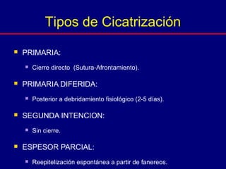  PRIMARIA:
 Cierre directo (Sutura-Afrontamiento).
 PRIMARIA DIFERIDA:
 Posterior a debridamiento fisiológico (2-5 días).
 SEGUNDA INTENCION:
 Sin cierre.
 ESPESOR PARCIAL:
 Reepitelización espontánea a partir de fanereos.
Tipos de Cicatrización
 