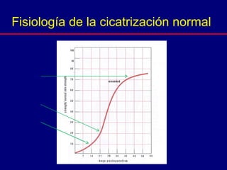 Fisiología de la cicatrización normal
 