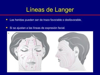  Las heridas pueden ser de trazo favorable o desfavorable.
 Si se ajustan a las líneas de expresión facial.
Líneas de Langer
 