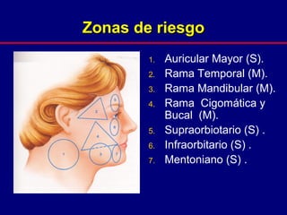 Zonas de riesgoZonas de riesgo
1. Auricular Mayor (S).
2. Rama Temporal (M).
3. Rama Mandibular (M).
4. Rama Cigomática y
Bucal (M).
5. Supraorbiotario (S) .
6. Infraorbitario (S) .
7. Mentoniano (S) .
 