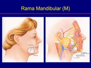 Rama Mandibular (M)
 