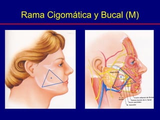 Rama Cigomática y Bucal (M)
 