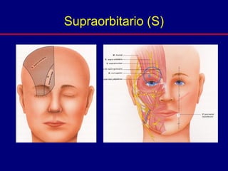 Supraorbitario (S)
 