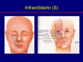 Infraorbitario (S)
 