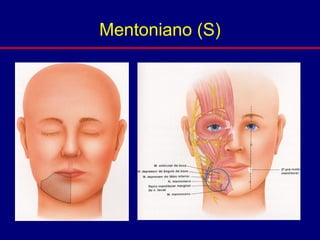 Mentoniano (S)
 