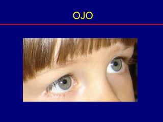 OJO
 