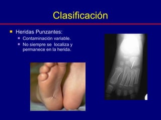  Heridas Punzantes:
 Contaminación variable.
 No siempre se localiza y
permanece en la herida.
Clasificación
 