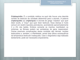 Criptoquirdia: É a condição médica na qual não houve uma descida
correta do testículo da cavidade abdominal para o escroto. A palavra
criptorquidia (ou criptorquia) é oriunda do grego “cripstos” que quer
dizer oculto, e “orqui” que quer dizer testículo. Essa doença é muito
comum em recém-nascidos prematuros, acometendo aproximadamente
3 a 4% dos bebês. Embora somente os machos manifestem os
sintomas, as fêmeas podem ser portadoras do gene responsável.
Outras possíveis complicações dessa condição são hérnias, torções
testiculares e, também, a infertilidade, sendo esta última consequência
da temperatura testicular inadequada. Caso o diagnóstico seja realizado
tardiamente, pode ser necessária orquiectomia.
DOENÇAS CAUSADAS PELO
HERMAFRODITISMO
 