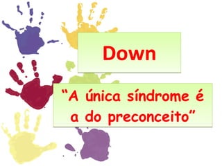Down “ A única síndrome é a do preconceito” 