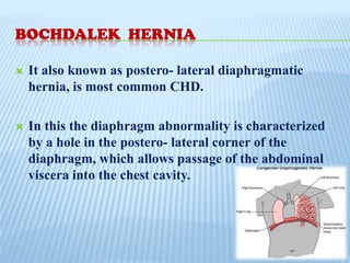 Hernia | PPTX