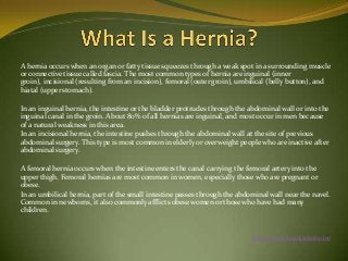 A hernia occurs when an organ or fatty tissue squeezes through a weak spot in a surrounding muscle
or connective tissue called fascia. The most common types of hernia are inguinal (inner
groin), incisional (resulting from an incision), femoral (outer groin), umbilical (belly button), and
hiatal (upper stomach).
In an inguinal hernia, the intestine or the bladder protrudes through the abdominal wall or into the
inguinal canal in the groin. About 80% of all hernias are inguinal, and most occur in men because
of a natural weakness in this area.
In an incisional hernia, the intestine pushes through the abdominal wall at the site of previous
abdominal surgery. This type is most common in elderly or overweight people who are inactive after
abdominal surgery.
A femoral hernia occurs when the intestine enters the canal carrying the femoral artery into the
upper thigh. Femoral hernias are most common in women, especially those who are pregnant or
obese.
In an umbilical hernia, part of the small intestine passes through the abdominal wall near the navel.
Common in newborns, it also commonly afflicts obese women or those who have had many
children.

http://www.drsanjaykolte.in/

 