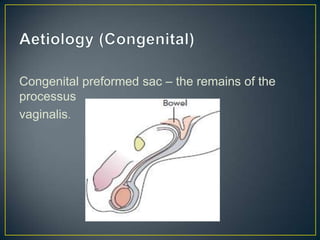 Hernia by Dr Hatem Elgohary | PPTX