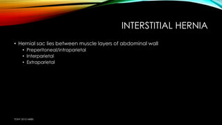 INTERSTITIAL HERNIA 
• Hernial sac lies between muscle layers of abdominal wall 
• Preperitoneal/intraparietal 
• Interparietal 
• Extraparietal 
TONY 2010 MBBS 
 