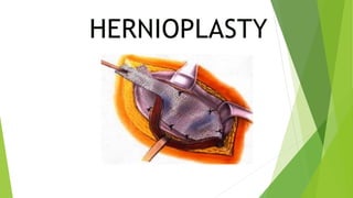 Herniation Rosh Hernia and its surgeries | PPTX