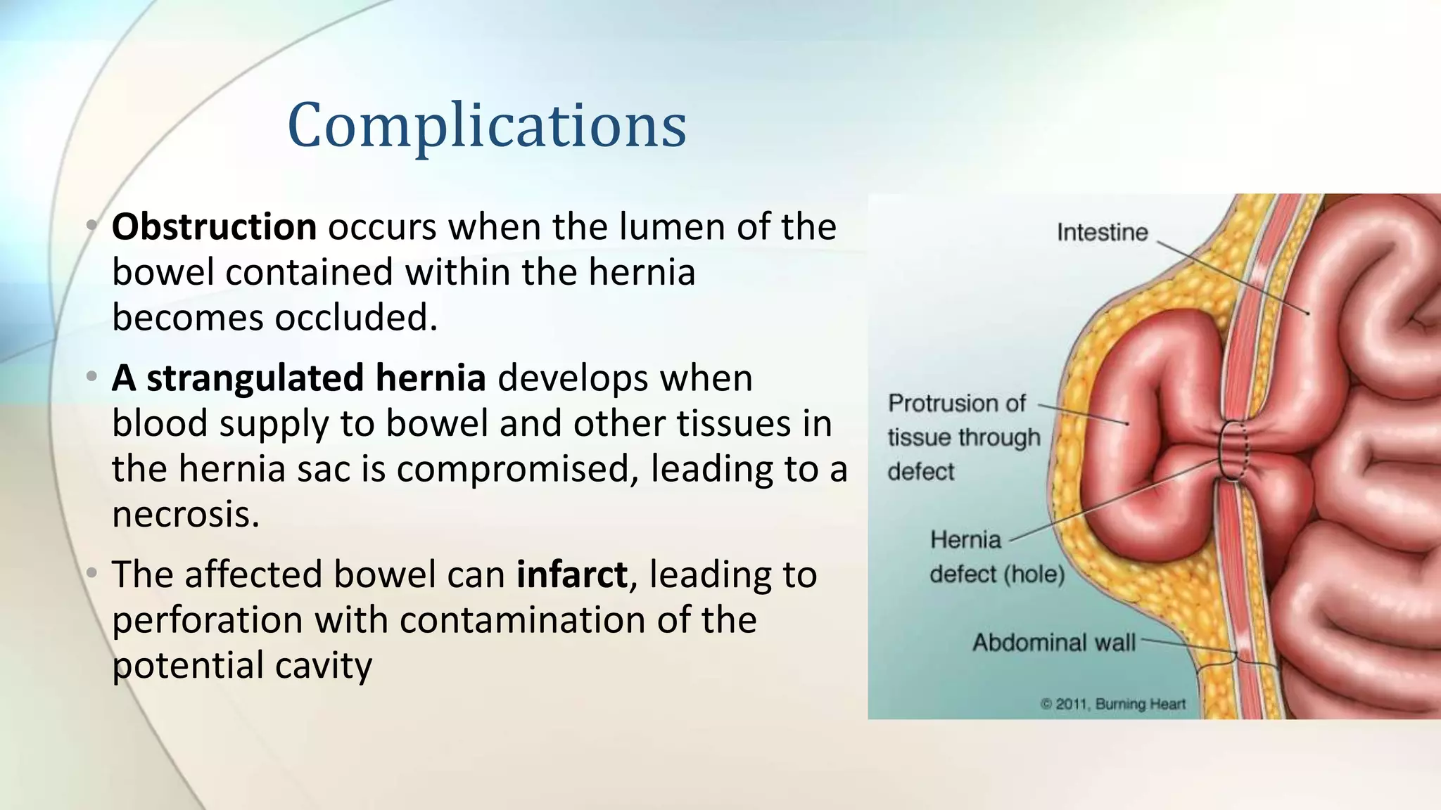 Nursing care of patients with Hernia | PPTX