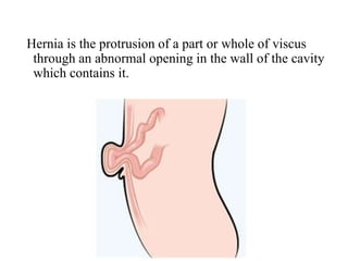 Hernia is the protrusion of a part or whole of viscus
through an abnormal opening in the wall of the cavity
which contains it.
 