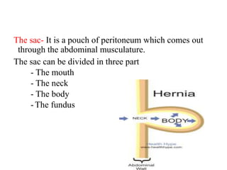 The sac- It is a pouch of peritoneum which comes out
through the abdominal musculature.
The sac can be divided in three part
- The mouth
- The neck
- The body
- The fundus
 