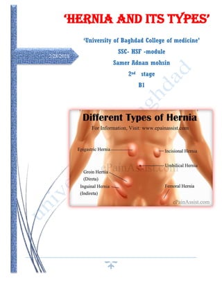 2/28/2018
‘Hernia and its types’
‘University of Baghdad College of medicine’
SSC- HSF -module
Samer Adnan mohsin
2nd stage
B1
 