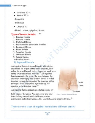 3 ‘Hernia and its types’
 Incisional 10 %.
 Ventral 10 %
- Epigastric
- Umbilical
 Others 5 %
- Hiatal, Lumbar, spigelian, Sciatic
Types of hernias include: 18
1. Inguinal Hernia
2. Femoral Hernia
3. Umbilical Hernia
4. Incisional and parastomal Hernias
5. Epicastric Hernia
6. Hiatal Hernia
7. Spigelian Hernia
8. Obturator Hernia
9. Sciatic Hernia
10.Lumbar Hernia
1) Inguinal Hernia
An inguinal hernia is a condition in which intra-
abdominal fat or part of the small intestine, also
called the small bowel, bulges through a weak area
in the lower abdominal muscles.19
An inguinal
hernia occurs in the groin [the area between the
abdomen and thigh]. This type of hernia is called
inguinal because fat or part of the intestine slides
through a weak area at the inguinal ring, the
opening to the inguinal canal.20
An inguinal hernia appears as a bulge on one or
both sides of the groin. And can occur any time
from infancy to adulthood and is much more
common in males than females. It’s tend to become larger with time.21
There are two types of inguinal hernia have different causes:
Figure 2 position of inguinal hernia
 