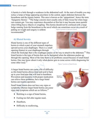 8 ‘Hernia and its types’
A hernia is a hole through a weakness in the abdominal wall. At the start of trouble you may
notice a lump or bulge appearing anywhere in the central, upper abdomen between the
breastbone and the tummy button. This area is known as the ‘epigastrium’, hence the term
‘Epigastric Hernia’. 48
The bulge consists most usually only of fatty tissue but when large
can contain gut. You may experience discomfort at first but it may become more painful
when lifting heavy objects or coughing. This hernia should not be confused with a large
bulge running from the breastbone to the navel which can sometimes occur as a result of
putting on weight and surgery is seldom
recommended.49
6) Hiatal hernia
Hiatal hernia is one of the different types of
hernia in which a part of your stomach impulses
upward across your diaphragm. There is a small
opening (hiatus) in your diaphragm through
which the food pipe that is the esophagus passes on its way to attach to the abdomen.50
This
hiatal hernia is the type of hernia that can be instigated when the abdomen pushes up
through this opening. Most of the time there is no problems caused because of small hiatal
hernia. One may know about it only when doctor gets to come across while diagnosing for
some other issue.51
A larger hiatal hernia can cause a bit of difficulty
as this hiatal hernia allows food and acid to back
up in your food pipe that will lead to heartburn.
Prevention and measures with proper medication
can relieve these problems, but a large hiatal
hernia can require operation.
Small hiatal hernia does not have any signs or
symptoms whereas larger hiatal hernia can cause
signs and symptoms which are as follows:52
 Belching is a sign of hiatal hernia,
 Feeling too full after regular meal,
 Heartburn,
 Difficulty in swallowing,
Figure 6 position of epicastric hernia
Figure 7 position of hiatal hernia
 