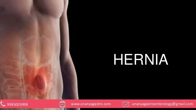 What Is A Hernia Types Of Hernias What Is A Hernia Types Of Hernias