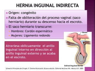  Origen: congénito
 Falta de obliteración del proceso vaginal (saco
herniario) durante su descenso hacia el escroto.
 El saco herniario transcurre:
 Hombres: Cordón espermático
 Mujeres: Ligamento redondo
Schwarts Principios de Cirugía. F. Charles Brunicardi; Octava edición. Editorial McGraw Hill. México D.F. 2005
Atraviesa oblicuamente el anillo
inguinal interno en dirección al
anillo inguinal externo y se acaba
en el escroto.
 
