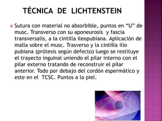  Sutura con material no absorbible, puntos en “U” de
musc. Transverso con su aponeurosis y fascia
transversalis, a la cintilla ileopubiana. Aplicación de
malla sobre el musc. Trasverso y la cintilla ilio
pubiana (prótesis según defecto) luego se restituye
el trayecto inguinal uniendo el pilar interno con el
pilar externo tratando de reconstruir el pilar
anterior. Todo por debajo del cordón espermático y
este en el TCSC. Puntos a la piel.
 