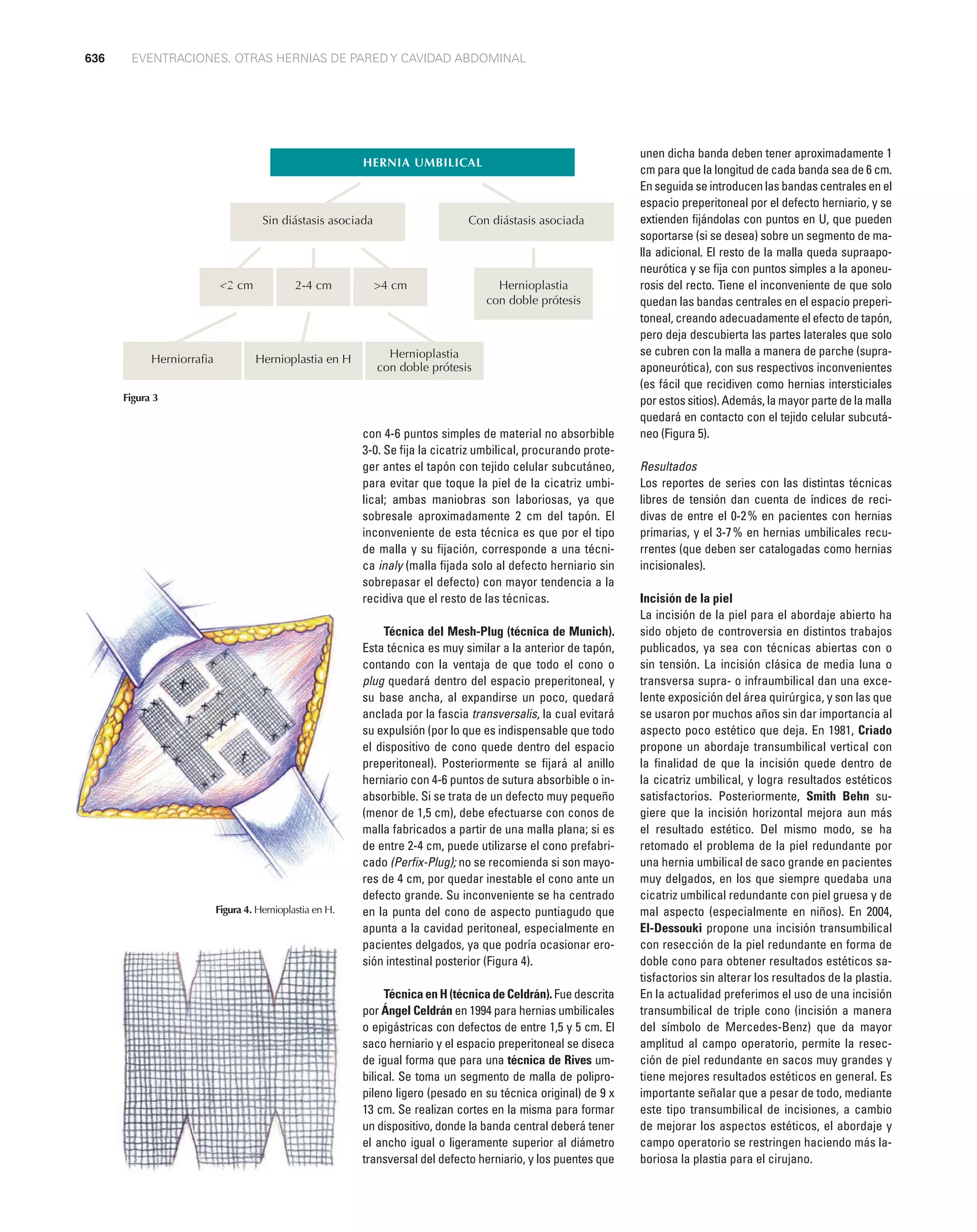 Hernia | PDF