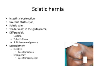 Sciatic hernia
• Intestinal obstruction
• Ureteric obstruction
• Sciatic pain
• Tender mass in the gluteal area
• Differentials
– Lipoma
– Tuberculoma
– Soft tissue malignancy
• Management
– Elective
• Open transgluteal
– Emergency
• Open transperitoneal
 