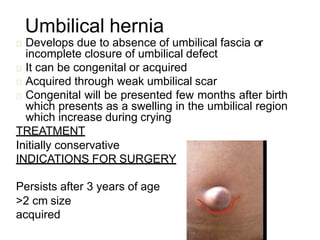 Umbilical Inverted Hernia | PPTX