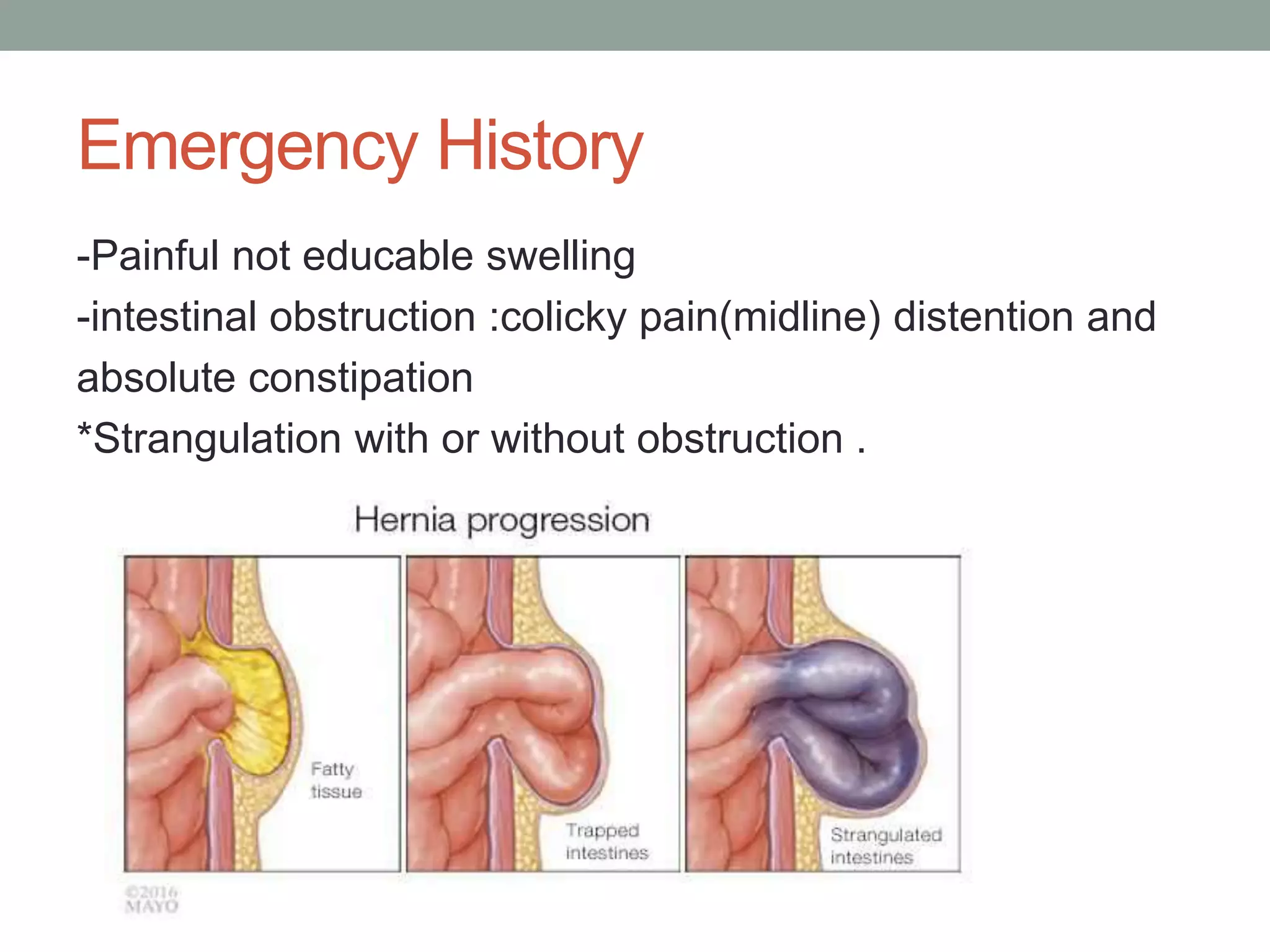 Hernias | PPTX