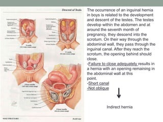 The occurrence of an inguinal hernia
in boys is related to the development
and descent of the testes. The testes
develop within the abdomen and at
around the seventh month of
pregnancy, they descend into the
scrotum. On their way through the
abdominal wall, they pass through the
inguinal canal. After they reach the
scrotum, the opening behind should
close.
-Failure to close adequately results in
a hernia with an opening remaining in
the abdominal wall at this
point.
-Short canal
-Not oblique
Indirect hernia
 