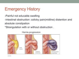 Emergency History
-Painful not educable swelling
-intestinal obstruction :colicky pain(midline) distention and
absolute constipation
*Strangulation with or without obstruction .
 