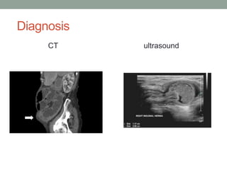 Diagnosis
CT ultrasound
 