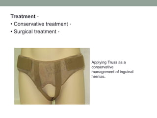 •
Treatment
•
• Conservative treatment
•
• Surgical treatment
Applying Truss as a
conservative
management of inguinal
hernias.
 