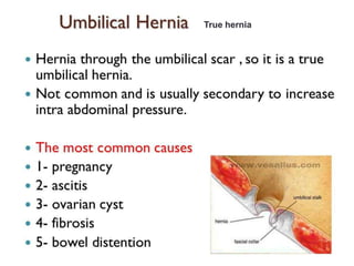 True hernia
 