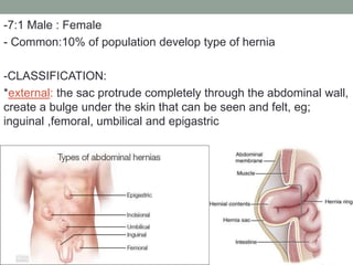 -7:1 Male : Female
- Common:10% of population develop type of hernia
-CLASSIFICATION:
*external: the sac protrude completely through the abdominal wall,
create a bulge under the skin that can be seen and felt, eg;
inguinal ,femoral, umbilical and epigastric
 