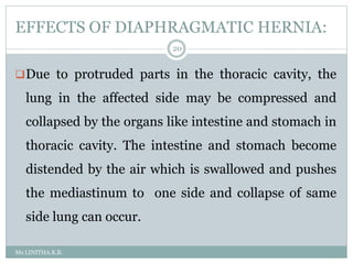 EFFECTS OF DIAPHRAGMATIC HERNIA:
Ms.LINITHA.K.B.
20
Due to protruded parts in the thoracic cavity, the
lung in the affected side may be compressed and
collapsed by the organs like intestine and stomach in
thoracic cavity. The intestine and stomach become
distended by the air which is swallowed and pushes
the mediastinum to one side and collapse of same
side lung can occur.
 