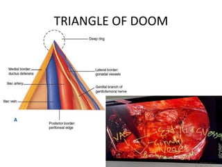 TRIANGLE OF DOOM
 