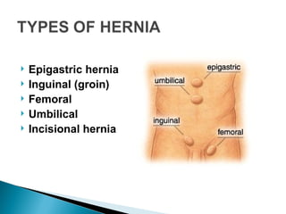  Epigastric hernia
 Inguinal (groin)
 Femoral
 Umbilical
 Incisional hernia
 