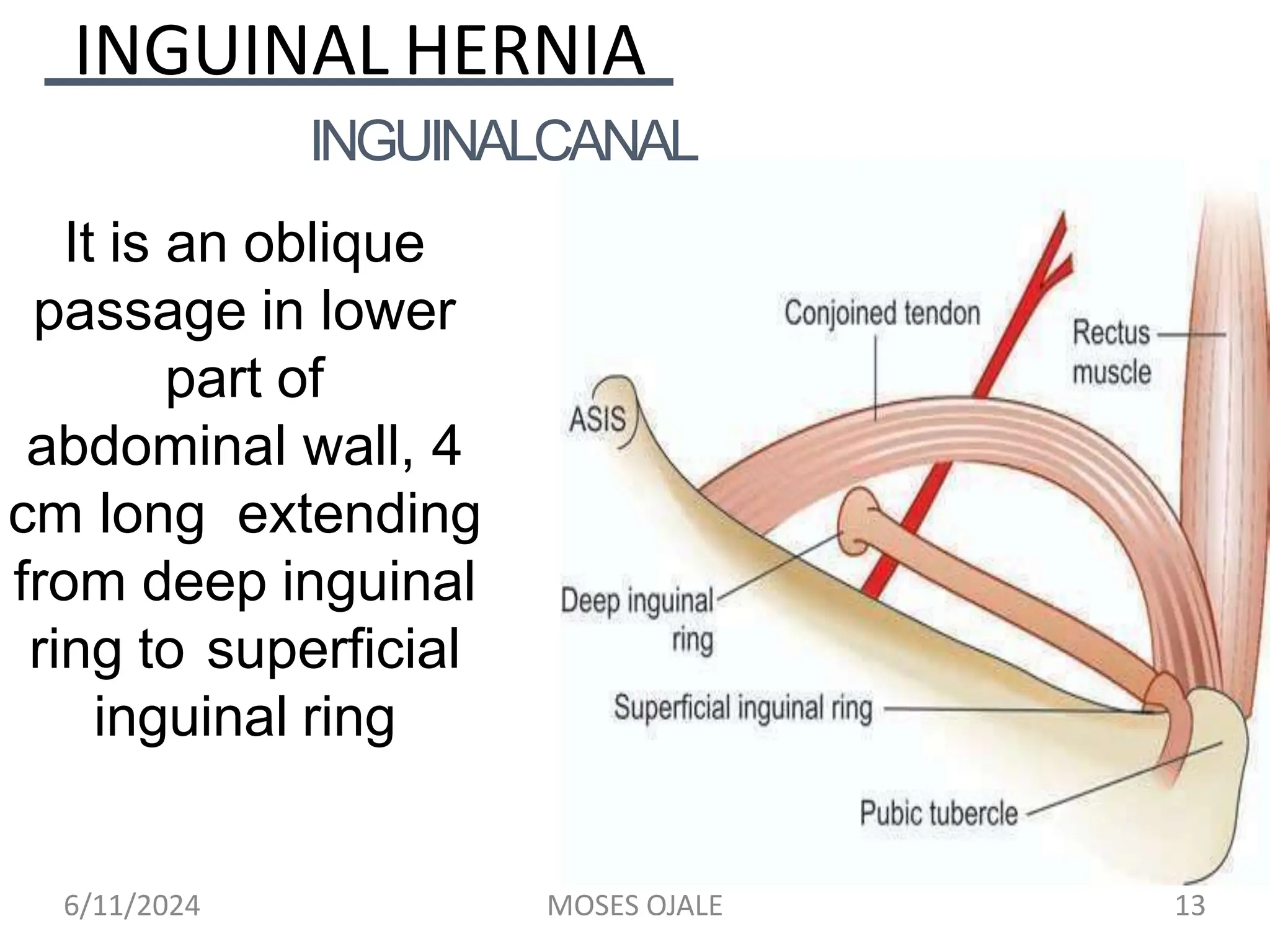 hernia- good notes for DCM COMPLETE.pptx