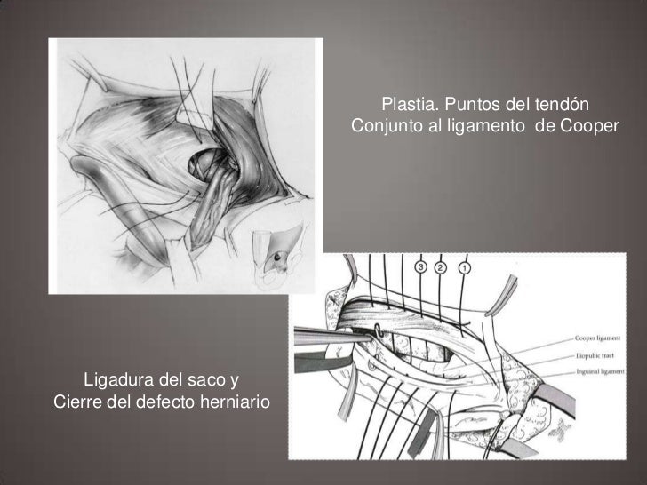 TECNICA DE SHOULDICE EBOOK DOWNLOAD TECNICA DE SHOULDICE EBOOK DOWNLOAD