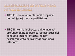 TIPO I: Hernia indirecta: anillo inguinal normal (p. ej. Hernia pediátrica) TIPO II: Hernia indirecta: anillo inguinal profundo dilatado pero pared posterior del conducto inguinal intacta; no hay desplazamiento de los vasos profundos inferiores 