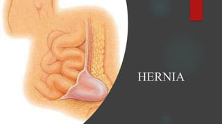 HERNIA
 