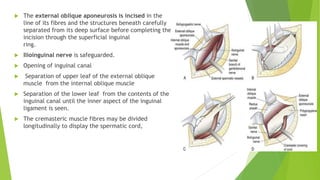  The external oblique aponeurosis is incised in the
line of its fibres and the structures beneath carefully
separated from its deep surface before completing the
incision through the superficial inguinal
ring.
 Ilioinguinal nerve is safeguarded.
 Opening of inguinal canal
 Separation of upper leaf of the external oblique
muscle from the internal oblique muscle
 Separation of the lower leaf from the contents of the
inguinal canal until the inner aspect of the inguinal
ligament is seen.
 The cremasteric muscle fibres may be divided
longitudinally to display the spermatic cord,
 