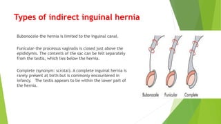 Types of indirect inguinal hernia
Bubonocele-the hernia is limited to the inguinal canal.
Funicular-the processus vaginalis is closed just above the
epididymis. The contents of the sac can be felt separately
from the testis, which lies below the hernia.
Complete (synonym: scrotal). A complete inguinal hernia is
rarely present at birth but is commonly encountered in
infancy. The testis appears to lie within the lower part of
the hernia.
 