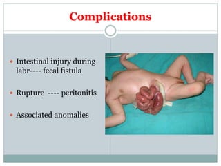 Complications
 Intestinal injury during
labr---- fecal fistula
 Rupture ---- peritonitis
 Associated anomalies
 